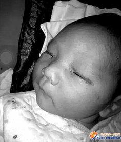 烧伤照片小孩,勇敢面对伤痛，共筑生命防线